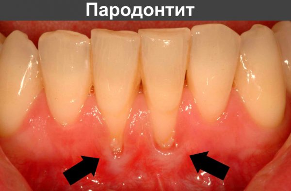 Десна опустилась