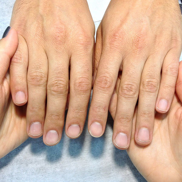 Форма ногтей зависит от подушечек пальцев