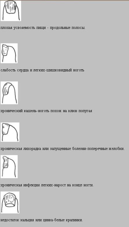 Диагностика по форме ногтя