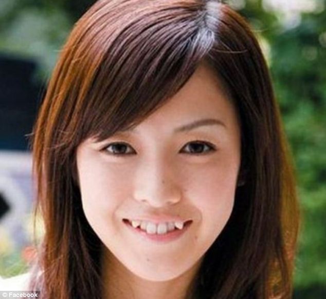 A young woman who has undergone a cosmetic procedure to get crooked, fang-like teeth after the look became popular in Japan