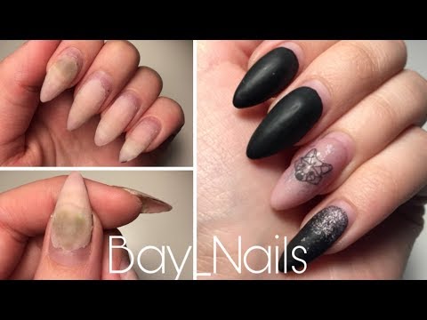 ПЛЕСЕНЬ НА НОГТЯХ/ЧТО ДЕЛАТЬ?! Bay_Nails