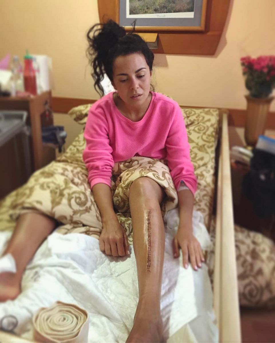 Настя Каменских показала устрашающие швы на ноге и рассказала о новой операции