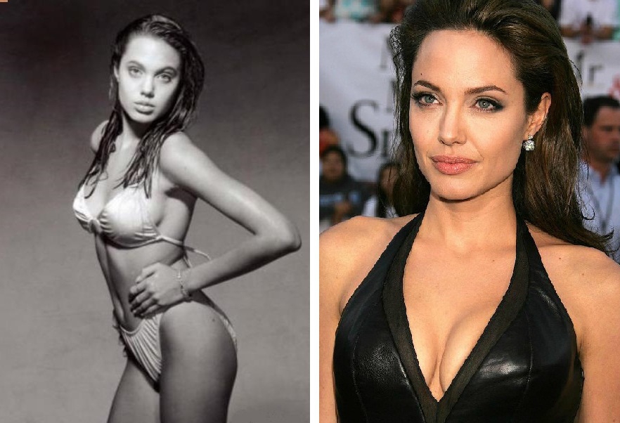 Анджелина Джоли грудь до и после