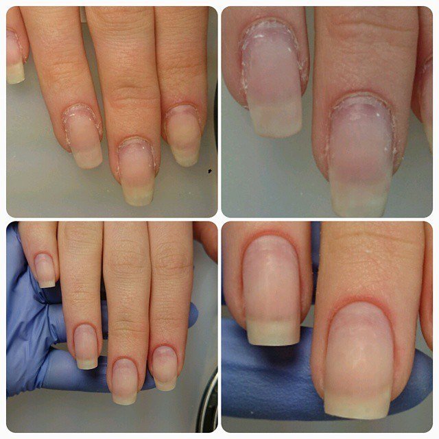 Ногти до и после комбинированного маникюра