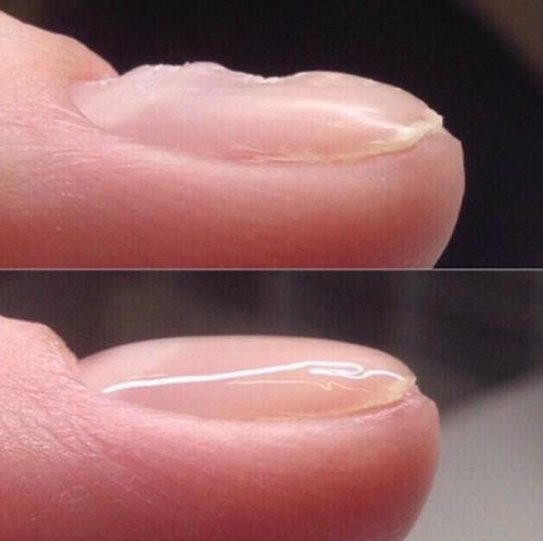 Выравнивание ногтевой пластины жидкой базой. Способы выравнивание ногтевой пластины