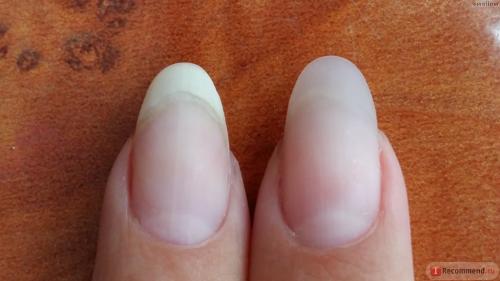 Выравнивание ногтевой пластины акриловой пудрой. Пудра для укрепления ногтей: показания к процедуре