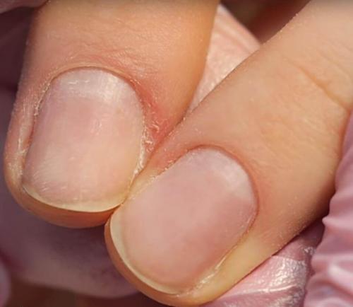 Пропилы на ногтях после аппаратного маникюра, что. 10 ошибок при аппаратном маникюре и как их избежать