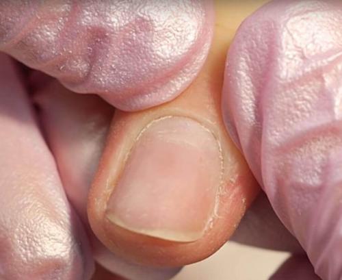 Пропилы на ногтях после аппаратного маникюра, что. 10 ошибок при аппаратном маникюре и как их избежать