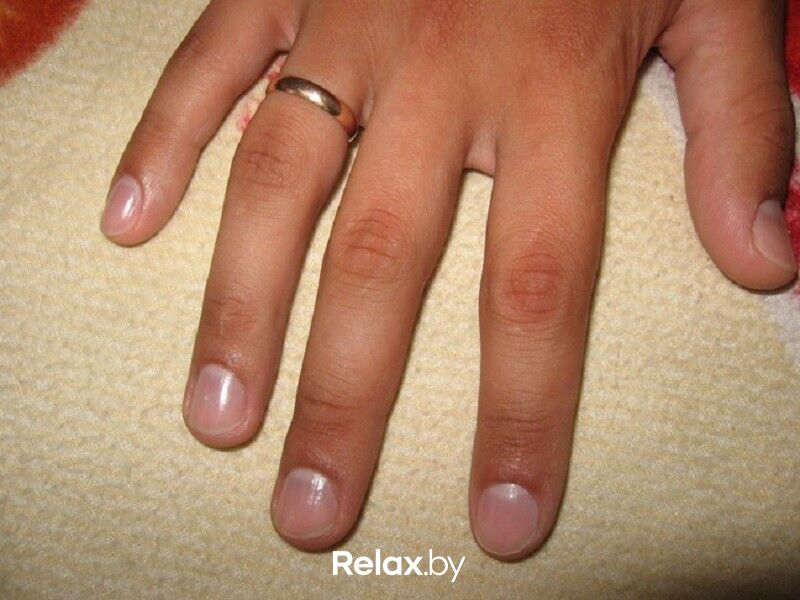 Какие должны быть ногти у здорового человека. Пальцы без маникюра. Длинные неухоженные ногти. Ухоженные и неухоженные ногти. Мужские ногти на руках.