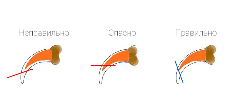 Памятка по правильному срезанию кончика когтя