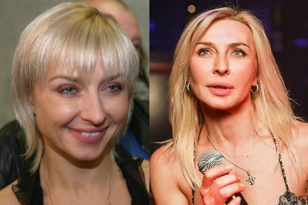 Эстрадная певица Татьяна Овсиенко до и после пластики лица фото
