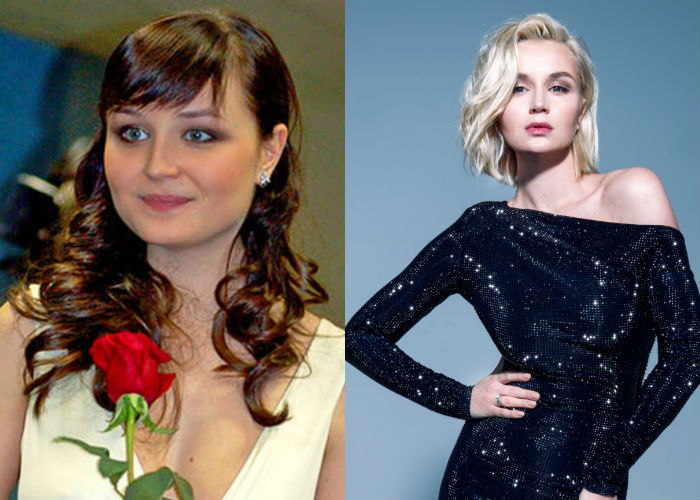 Известная русская певица красавица Полина Гагарина до и после удачной многочисленной пластики лица и похудения на 40 килограмм фото