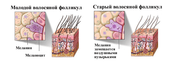 Причины седины волос